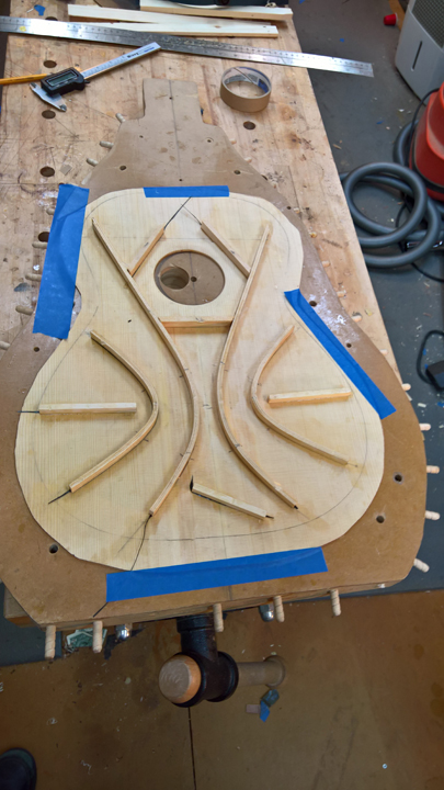 Braces profiled — 10mm primary, 7mm secondary